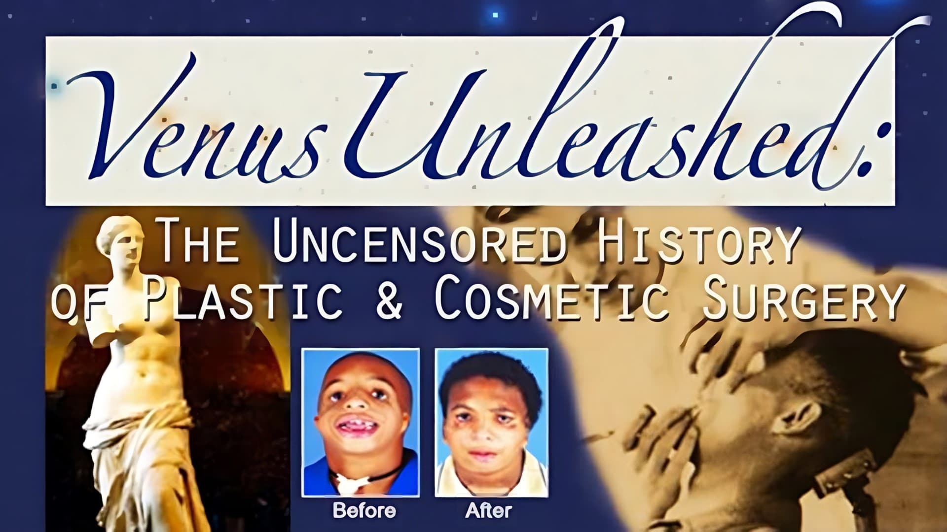 Venus Unleashed The History Of Plastic Surgery